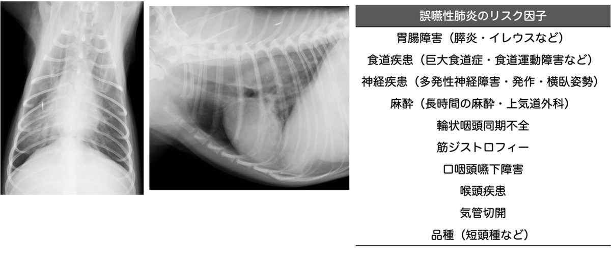 呼吸14